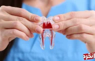ساخت دندان با استفاده از سلول‌های بنیادی جایگزین مناسب ایمپلنت خواهد شد...