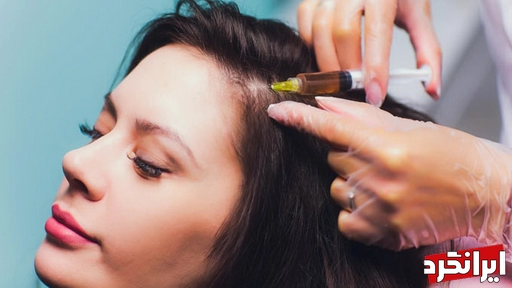 درمان ریزش مو با سلول های بنیادی